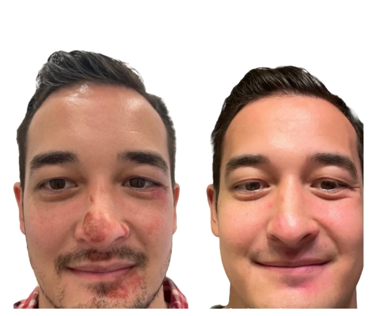 X F -LED AT HOME MASK