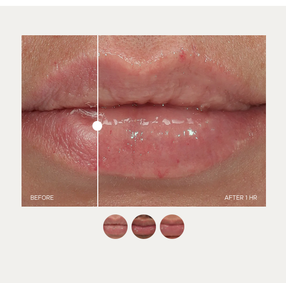 Anfisa An-Gloss